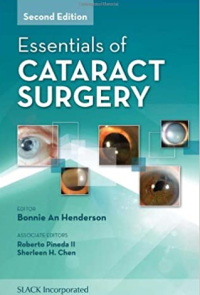 essential of cataract surgery second edition