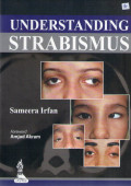 understanding strabismus