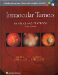 Intraocular tumors an atlas and textbook third edition