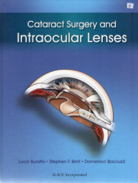 Cataract surgery and intraocular lenses