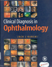 clinical diagnosis in ophthalmology