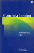 glaucoma imaging