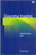 glaucoma imaging